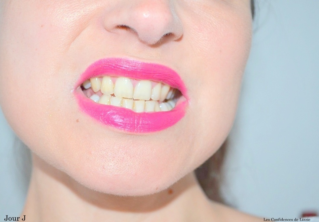 dents-blanches-avec-charbon