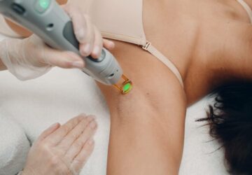 details conseils epilation laser