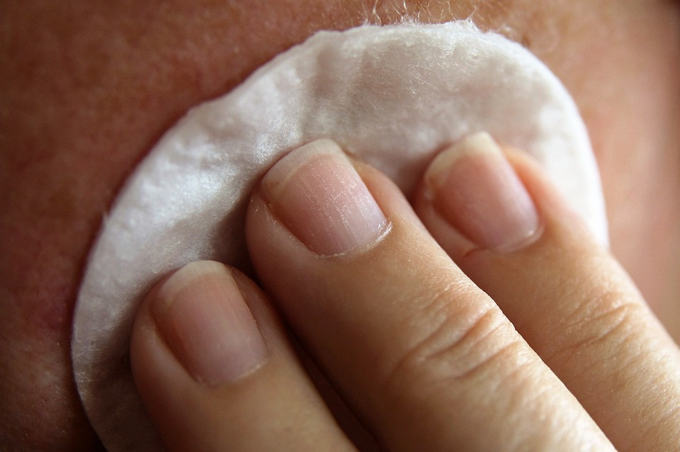 acne-sur-les-joues