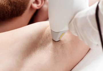 se-faire-epiler-au-laser-infos-a-ne-pas-negliger