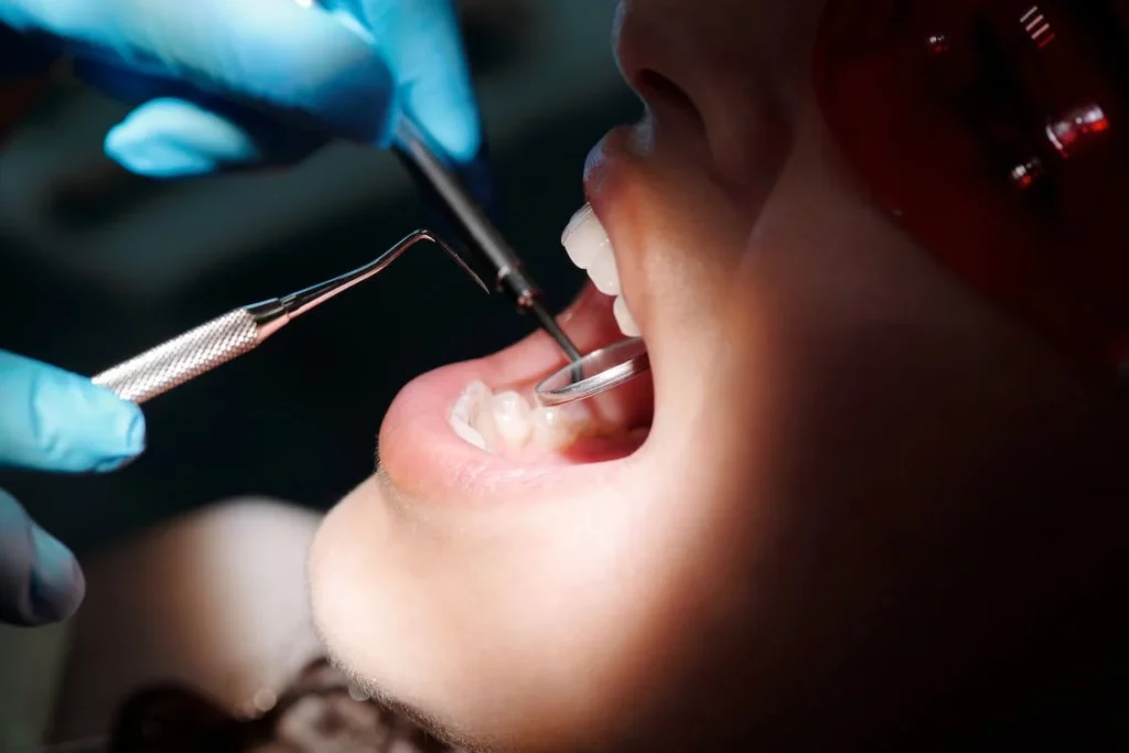 extraction-dentaire-mon-temoignage